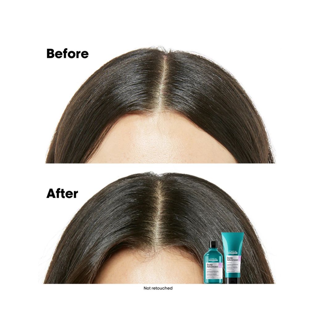L'Oréal Professionnel Scalp Advanced Anti-Discomfort Shampoo — +73% soothing after 1 use, sensitive scalp relief