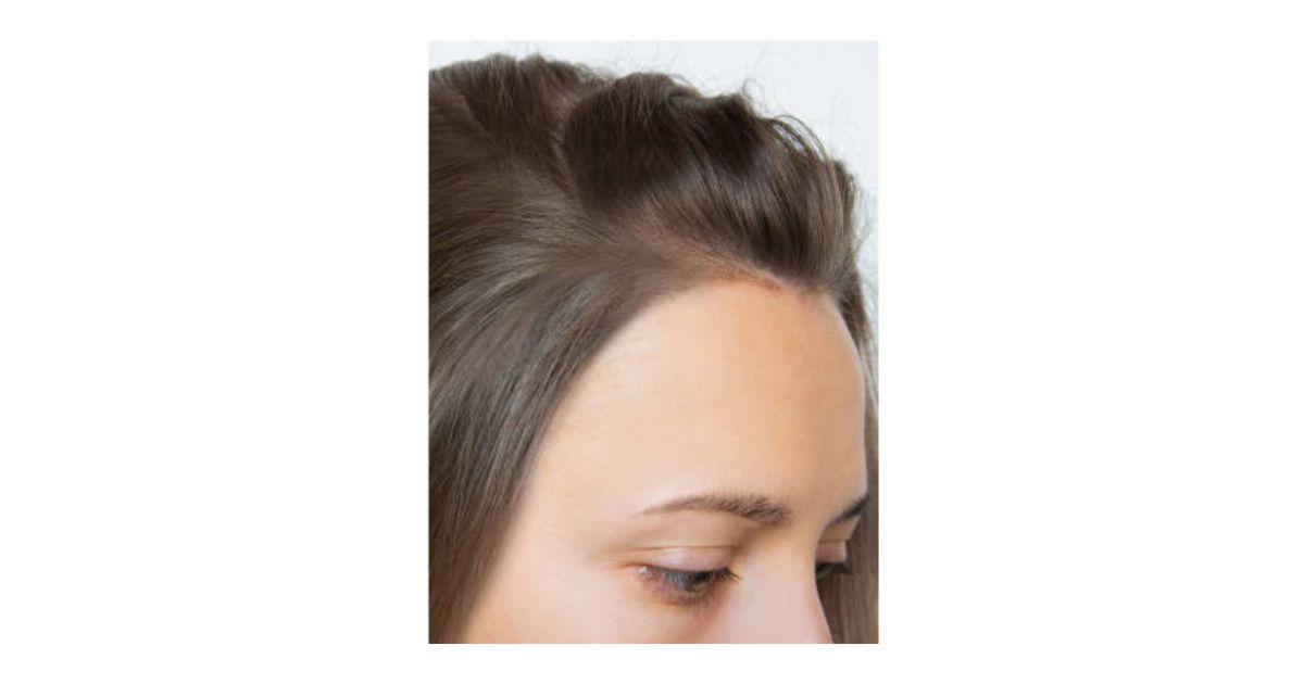 Hair with more Density and Thickness