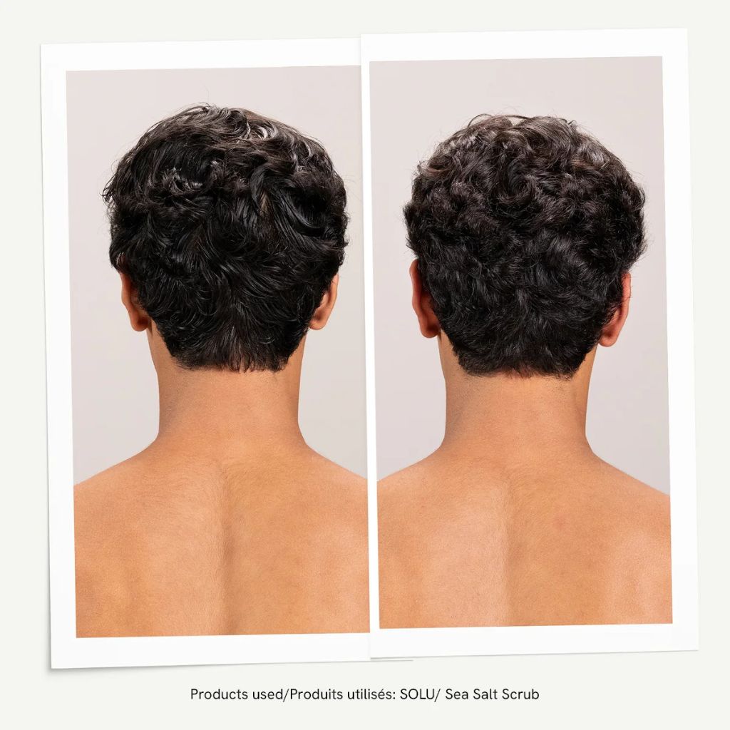Davines Scalp Favorites Bundle