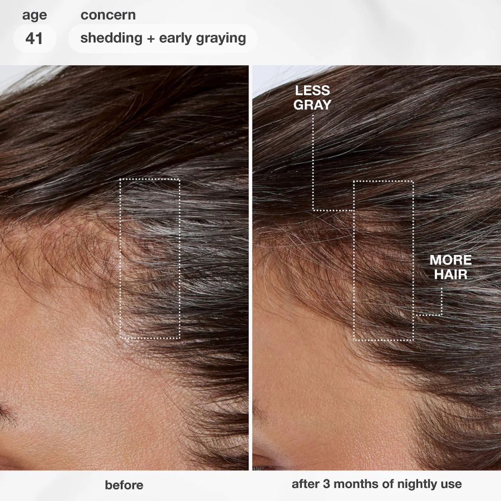 K18 FutureIQ Hair Longevity Serum