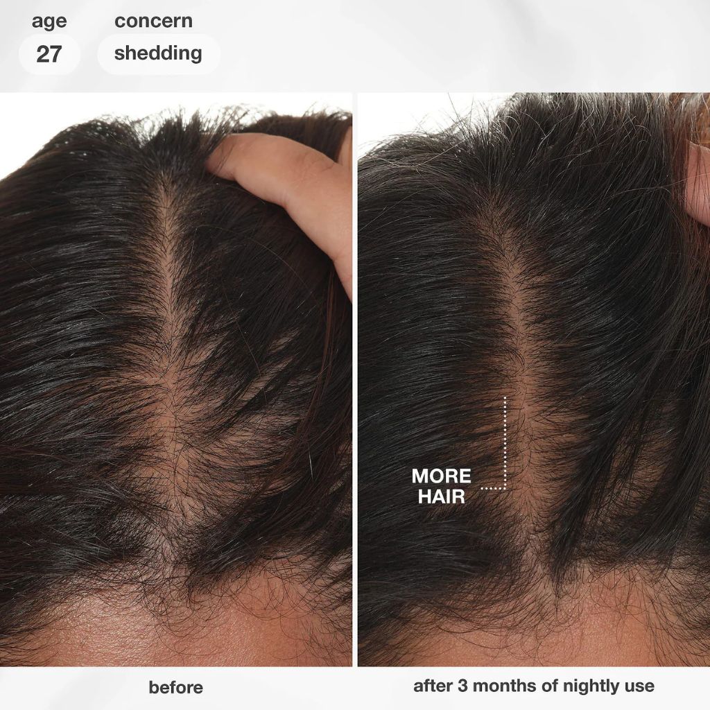 K18 FutureIQ Hair Longevity Serum