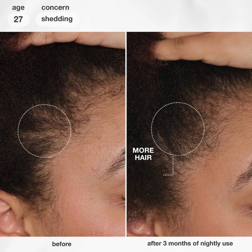 K18 FutureIQ Hair Longevity Serum