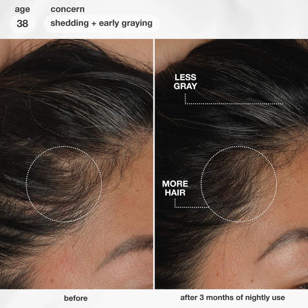 K18 FutureIQ Hair Longevity Serum