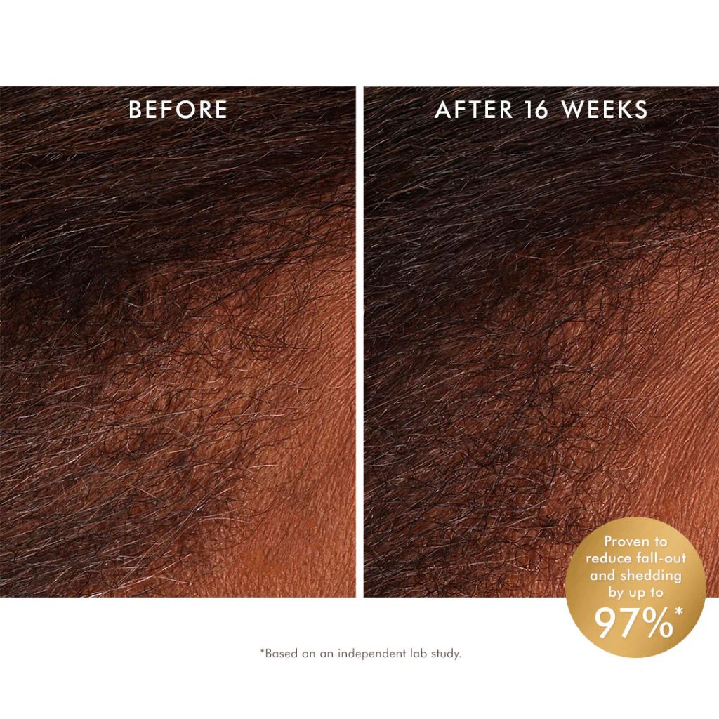 MoroccanOil Scalp Revitalizing Bundle - Zennkai