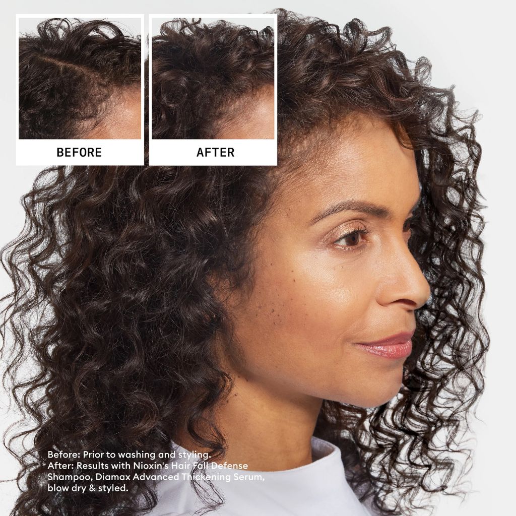 Nioxin Ultimate Power Hair Fall Defense Shampoo - Zennkai