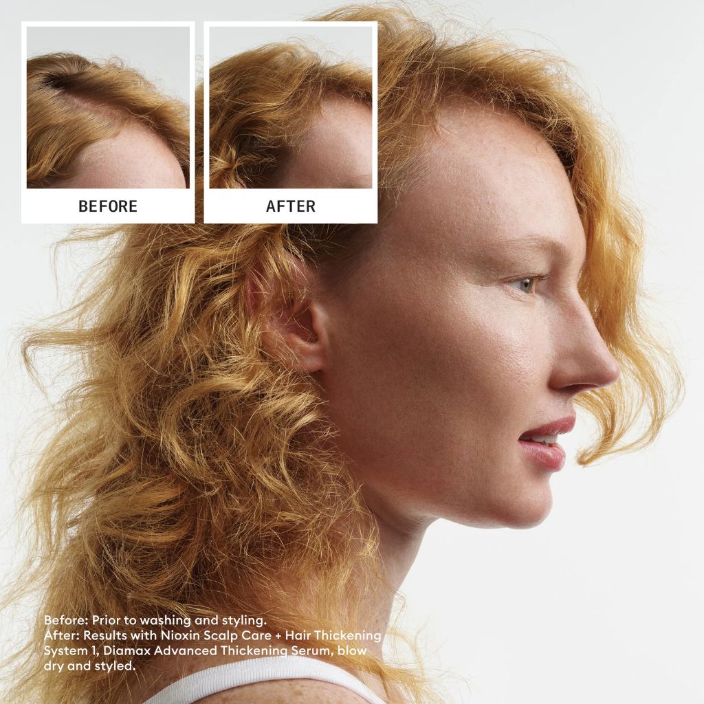 Nioxin System 1 Kit for Light Thinning Before and After - Zennkai