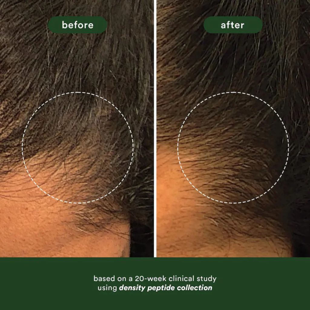 VERB Density Peptide Duo for Thinning Hair - Zennkai