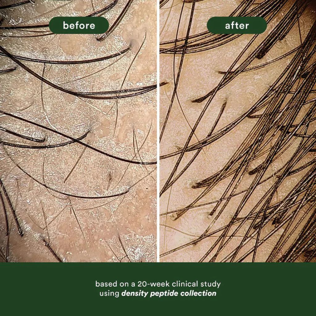 VERB Density Peptide Duo for Thinning Hair - Zennkai